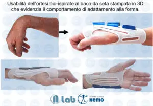 Esempi-uso-ortesi-in